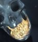 Photo8: Single Skull With Pure Gold Wrap Teeth Pendant